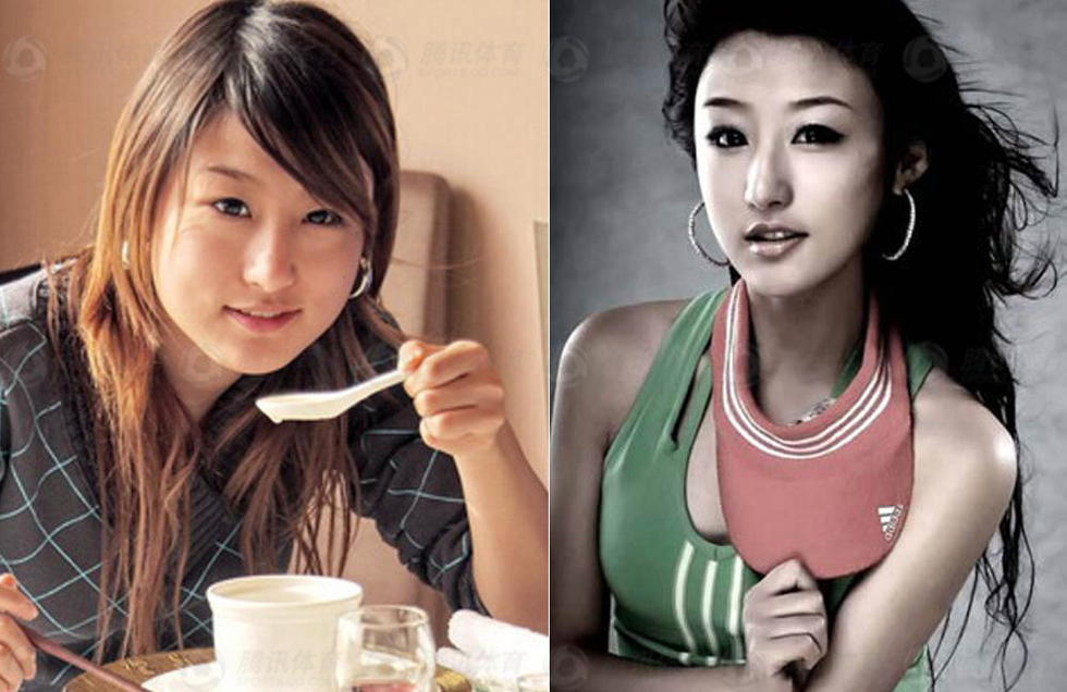 足球宝贝整容吓死人(组图)